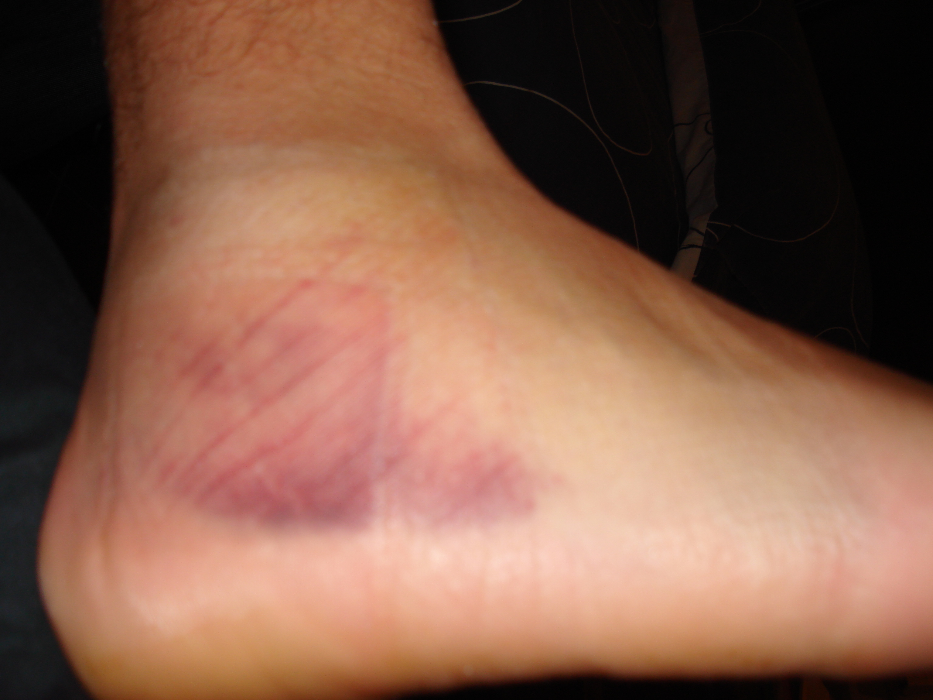 ELYTIS Hospital: Durerile articulare – cauze, diagnostic şi prevenţie